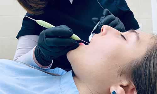 Laser treatment